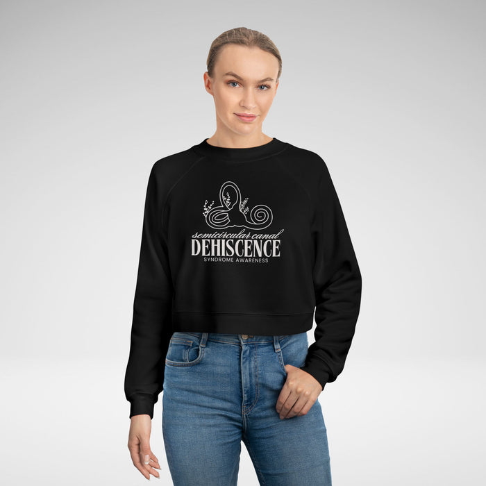 Semicircular Canal Dehiscence Syndrome Awareness Women's Cropped Fleece Pullover
